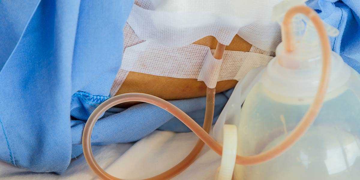 Medical Tubing Lawyer Houston Personal Injury Attorney